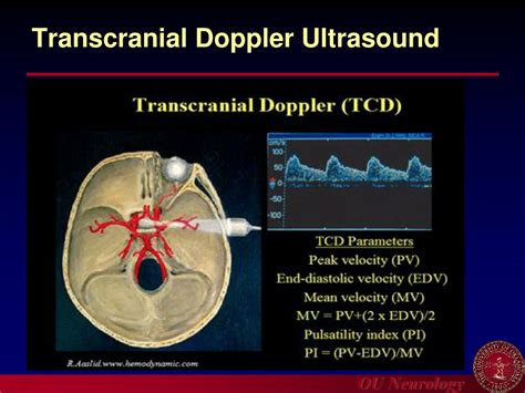 PPT - Introduction to Carotid Ultrasound and Transcranial Doppler Ultrasound PowerPoint ...