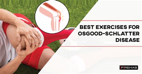 Best Exercises for Osgood-Schlatter Disease – [𝗣]𝗥𝗲𝗵𝗮𝗯