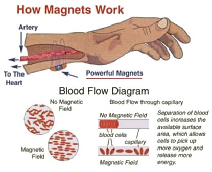 Peninsula Massage – What is Magnetic Therapy?