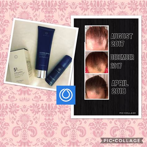 Monat results!! My hair has grown so much in length but most impressive is the regrowth and how ...