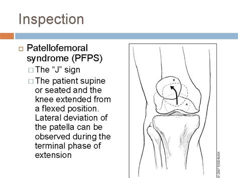 THE EXAMINATION OF THE KNEE ECHO SPORTS MEDICINE