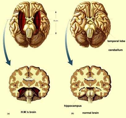 Patient HM’s Passing – Brainy Behavior