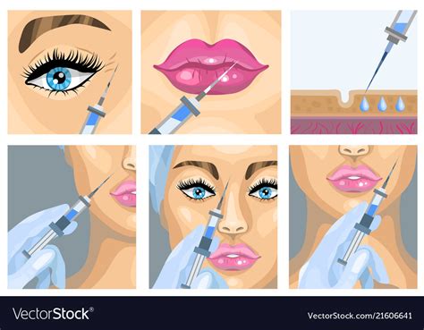 Botox injection cosmetic procedure set Royalty Free Vector