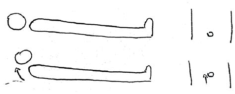 Beevor sign: When the patients lift their head, their umbilicus... | Download Scientific Diagram