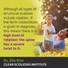 Rotoscoliosis: Symptoms, Causes, and Treatment Options