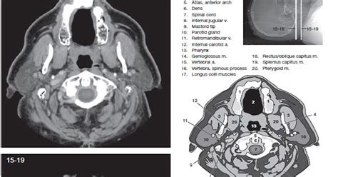 Neck CT Scan Procedure and Protocol - RadTechOnDuty