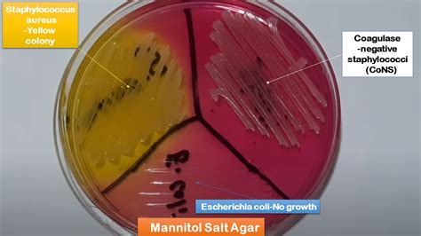 Mannitol Salt Agar: Introduction, Composition, Preparation, Colony Charact