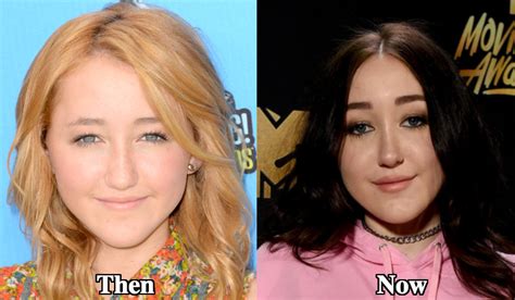 Noah Cyrus Plastic Surgery Before and After Photos - Latest Plastic Surgery Gossip And News ...