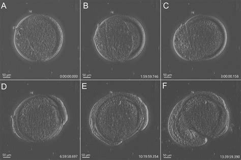 Overview of Microscopy Techniques for Life Sciences- Oxford Instruments