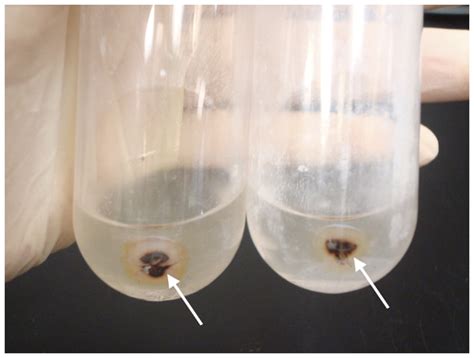 The isolated inclusion bodies obtained from 6 g of IBD+ liver. The ...