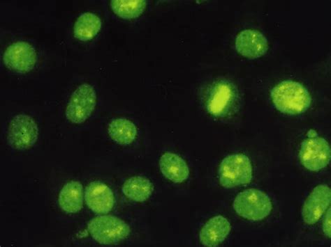 Antikörper gegen DNA Topoisomerase I (Scl-70):