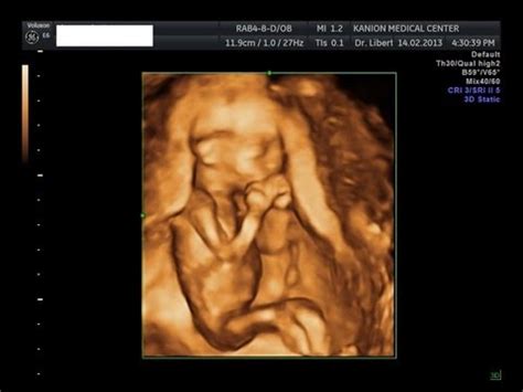 16 Week FULL 3D 4D Ultrasound - Must See!!! It's a BOY! - YouTube