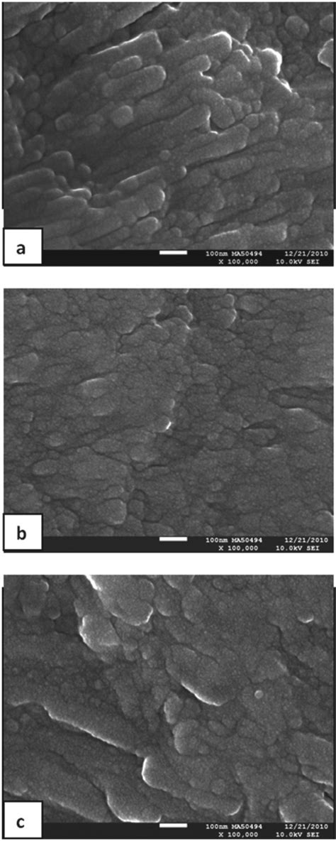 Fluoride plus functionalized β-TCP: a promising combination for robust remineralization ...