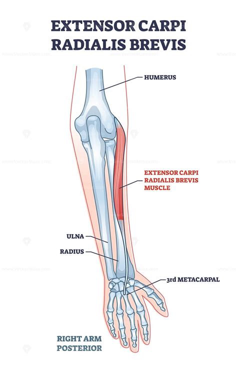 Extensor carpi radialis brevis muscle with arm and hand bones outline diagram – VectorMine