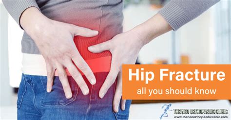 HIP FRACTURES: ALL YOU NEED TO KNOW – Neo Orthopaedic Clinic