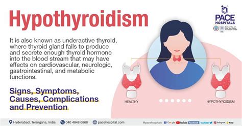 Hypothyroidism – Symptoms, Causes, Complications and Prevention