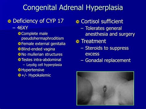 Congenital Adrenal Hyperplasia