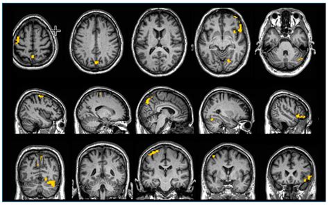 Magnetic Resonance Imaging