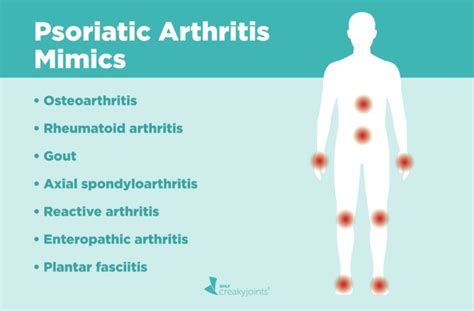 Psoriatic Arthritis Misdiagnosis: Diseases PsA Can Be Mistaken For