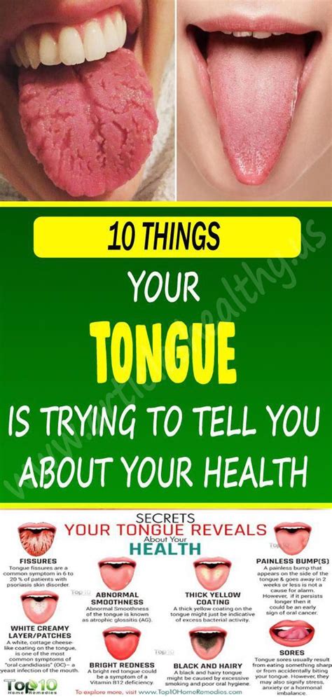 WHAT YOUR TONGUE IS TRYING TO TELL YOU ABOUT YOUR HEALTH | Health ...