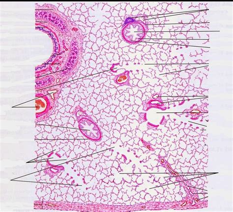 Pulmonary Artery Histology