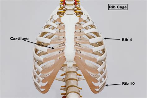 Separated Ribs? Not What You Think