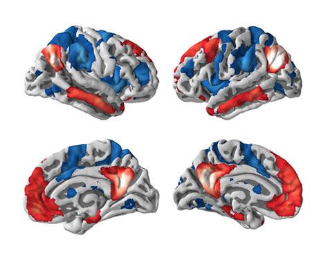 Consciousness Harmed by Abnormal Brain Interactions - Neuroscience News