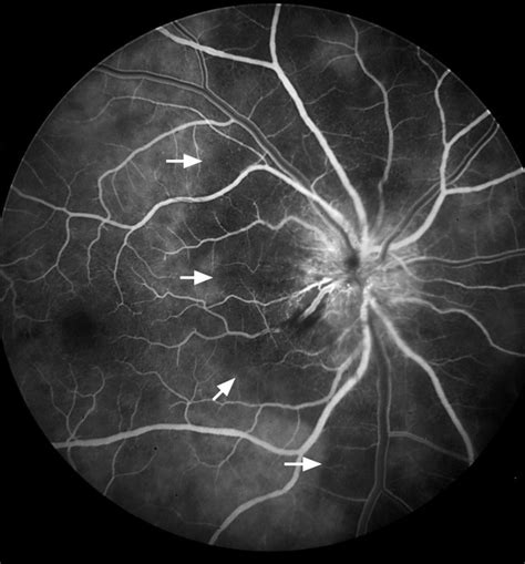 Optic Nerve Disorders Diagnosis | AccessMedicine Network