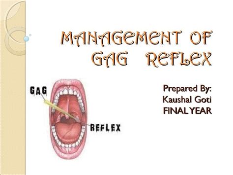 Gag reflex management