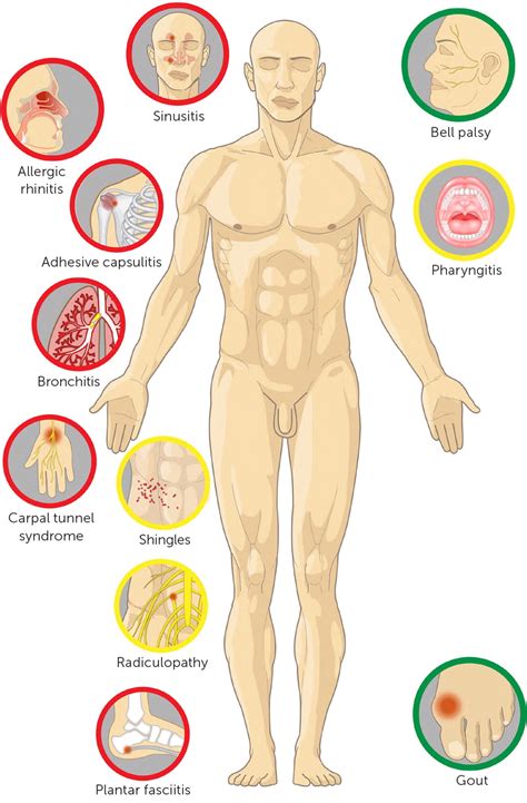 Steroids Drug Effects