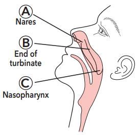 Perform a Nasal Swab Sample Collection