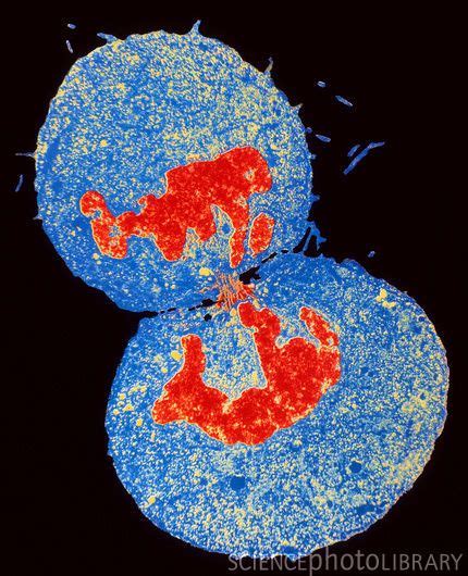 TEM micrograph of cytokinesis during mitosis of human embryonic kidney ...