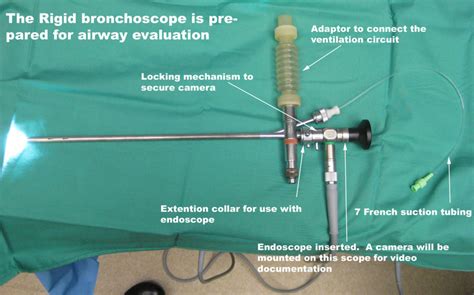 Bronchoscopy - Uses, Fiberoptic, Ebus, Rigid, Side Effects