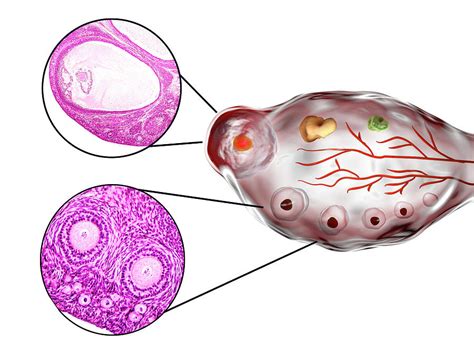 Ovarian Follicles Photograph by Kateryna Kon/science Photo Library - Pixels