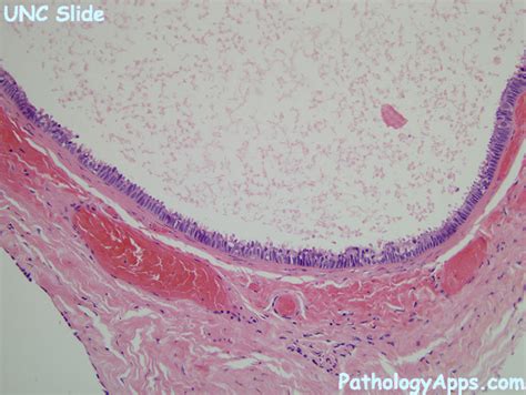 appendix epididymis testis histology