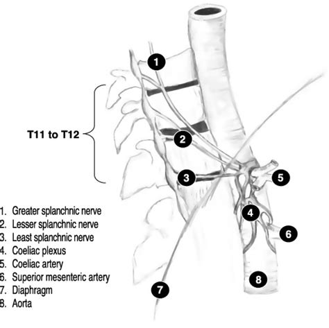 Fluoroscopic Guided Celiac Plexus/Splanchnic Nerve Block - Technique and Overview - The ...