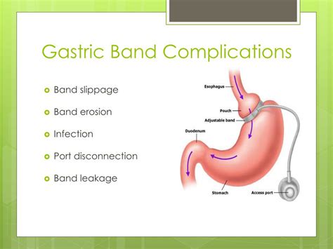 PPT - Bariatric Surgery and Pregnancy PowerPoint Presentation, free ...