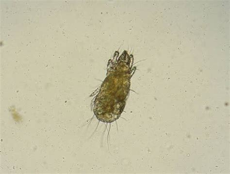 cereal mite Archives - Dr Vivek Kumar