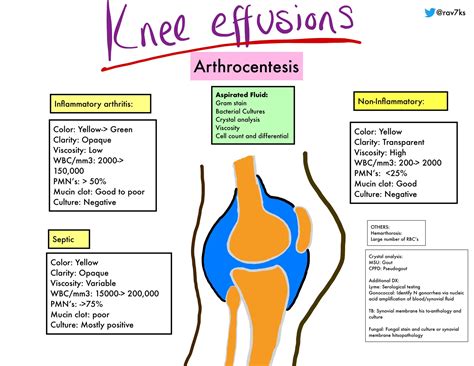 Synovial fluid in knee joint - felikauction