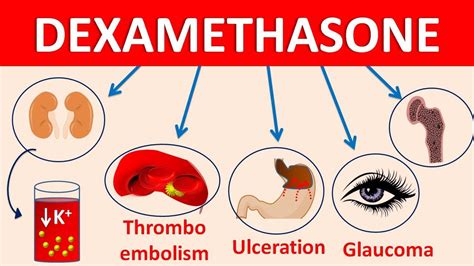 Dexamethasone tablets (decadron) || Mechanism, side effects ...