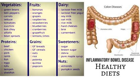 Inflammatory Bowel Disease Diet – For Symptoms Free Life | Inflammatory bowel disease diet ...