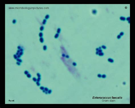 Enterococcus faecalis micrograph. Gram stain. Enterococci under microscope. Gram-positive bacteria.