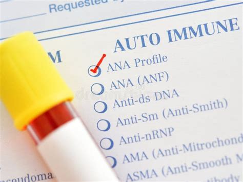 Blood Sample for Antinuclear Antibody or ANA Test Stock Photo - Image ...