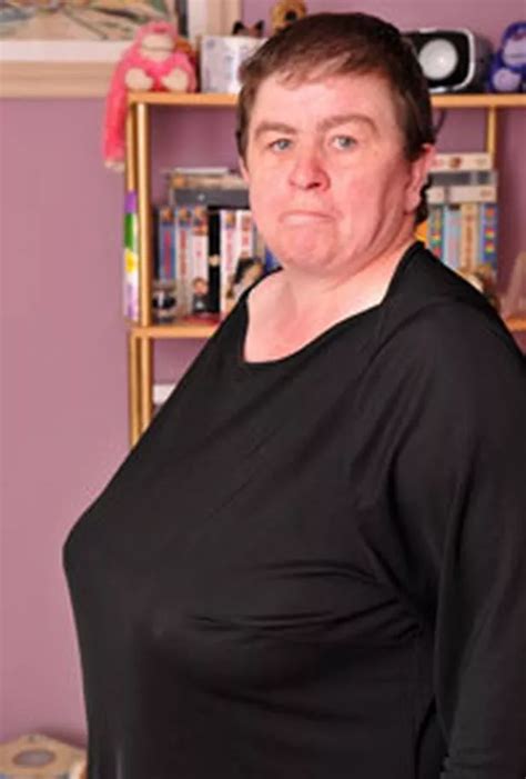 Coulby Newham woman fights for breast reduction on NHS - Teesside Live