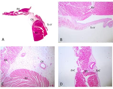 Interventricular Septum Histology