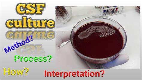 CSF Culture test procedure Microbiology - YouTube