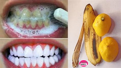 At home teeth whitening diy in 3 minutes / fastest way to whiten teeth ...