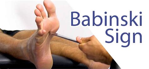 Babinski reflex test & causes of positive Babinski reflex in adults