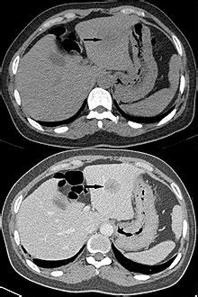 Contrast CT - Wikipedia