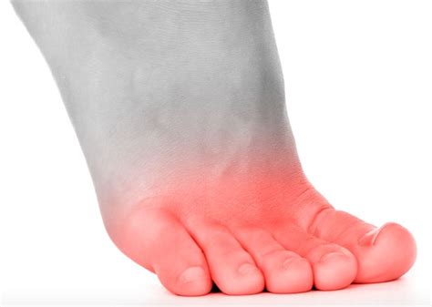 Foot Pain Diagnosis: What's Causing Your Pain?